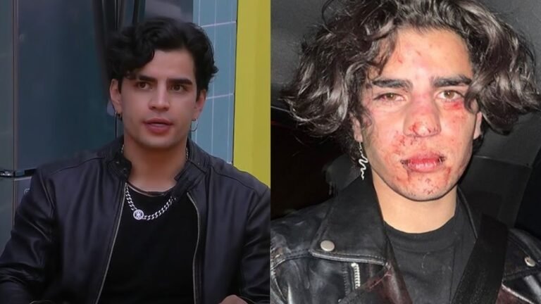 Aarón Mercury dió detalles inéditos de la golpiza que sufrió en un antro de Querétaro en 2022