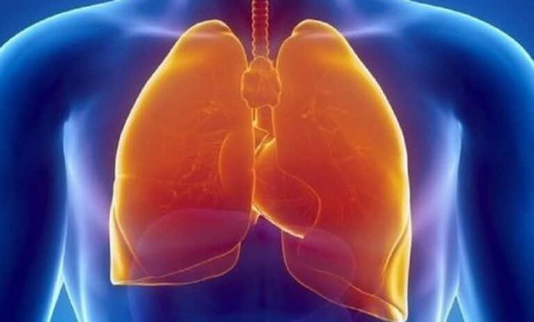 Se suma SESA Querétaro a la conmemoración del Día Nacional Contra el Cáncer de Pulmón